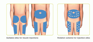Skema lokasi injeksi insulin untuk rotasi di sekitar perut.